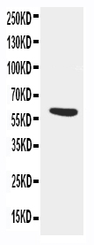 1 - Anti-Alpha 1 Antichymotrypsin Antibody ABO11527
