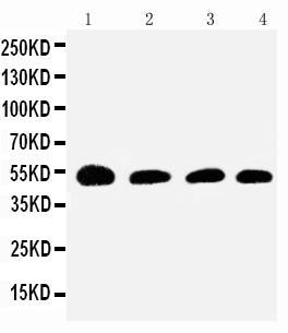 1 - Anti-Serpin C1/Antithrombin-III Antibody ABO11528