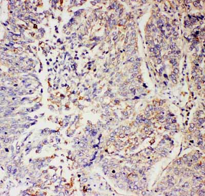2 - Anti-SLC9A2 Antibody ABO11529