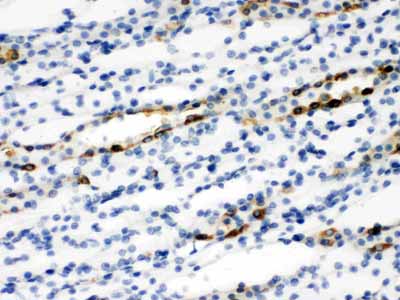 2 - Anti-SLC9A2 Antibody ABO11529