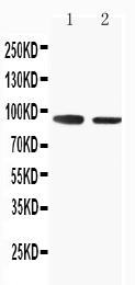 1 - Anti-SLC9A2 Antibody ABO11529