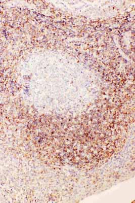 2 - Anti-Diubiquitin Antibody ABO11532