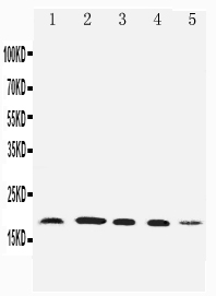 1 - Anti-Diubiquitin Antibody ABO11532