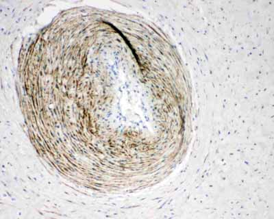2 - Anti-Calponin Antibody ABO11534