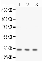 1 - Anti-Calponin Antibody ABO11534