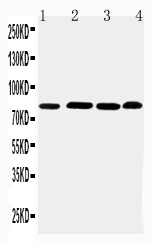 1 - Anti-PROX1 Antibody ABO11539