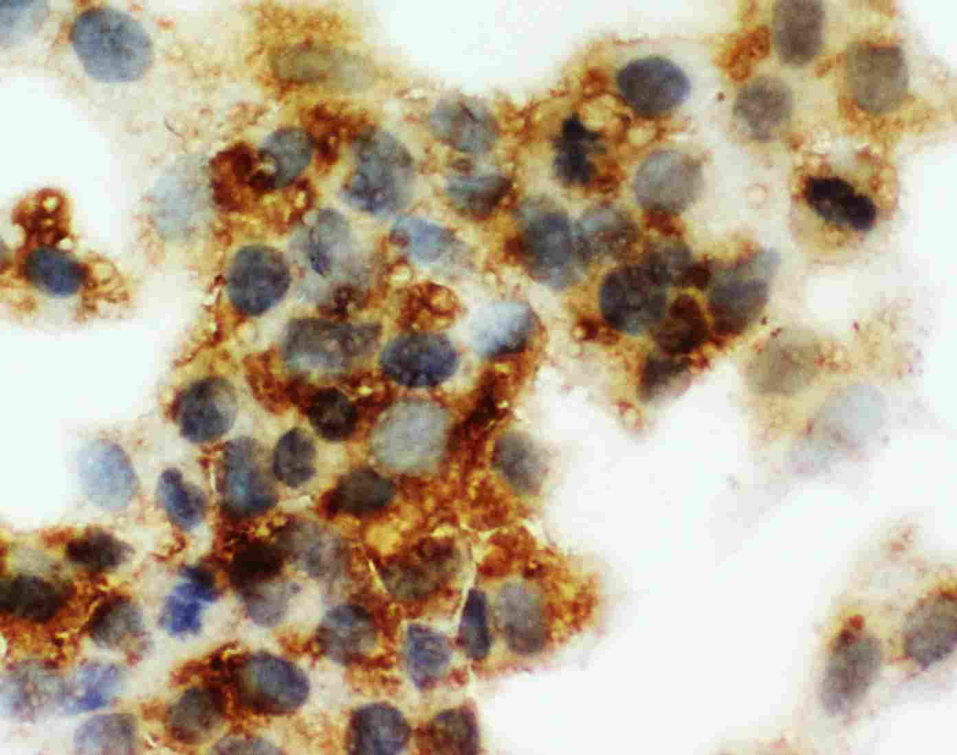 8 - Anti-Cortisol Binding Globulin Antibody ABO11540