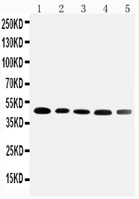 1 - Anti-Cortisol Binding Globulin Antibody ABO11540