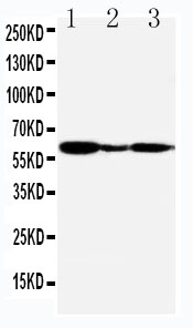 1 - Anti-G-Protein Coupled Receptor 30 Antibody ABO11545