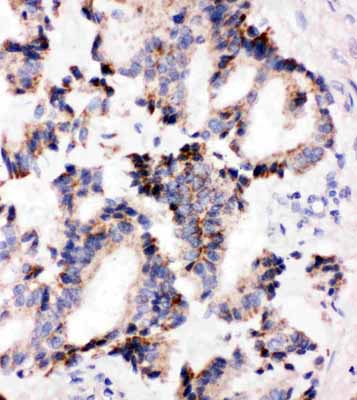 2 - Anti-IRAK2 Antibody ABO11546