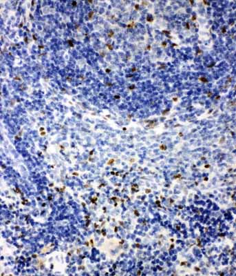 2 - Anti-IRAK2 Antibody ABO11546