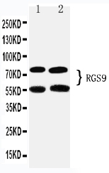 1 - Anti-RGS9 Antibody ABO11551