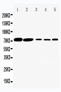 1 - Anti-SGLT1 Antibody ABO11554