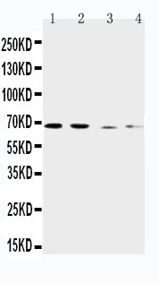 1 - Anti-CAT1 Antibody ABO11555