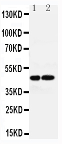 1 - Anti-AVPR1A Antibody ABO11558