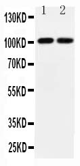 1 - Anti-GRIA3 Antibody ABO11559