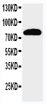 1 - Anti-NCSTN Antibody ABO11560
