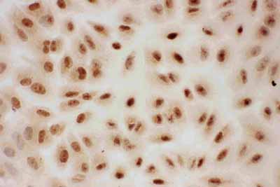8 - Anti-PIAS1 Antibody ABO11562