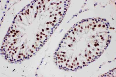 2 - Anti-PIAS1 Antibody ABO11562