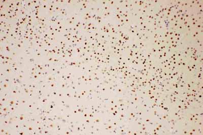 2 - Anti-PIAS1 Antibody ABO11562
