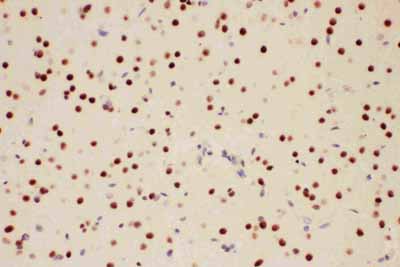 2 - Anti-PIAS1 Antibody ABO11562