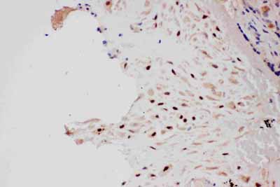 2 - Anti-PIAS1 Antibody ABO11562