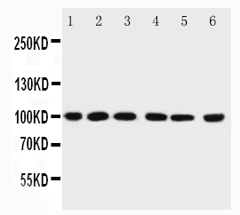1 - Anti-PIAS1 Antibody ABO11562