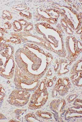 2 - Anti-TNFAIP8L3 Antibody ABO11567