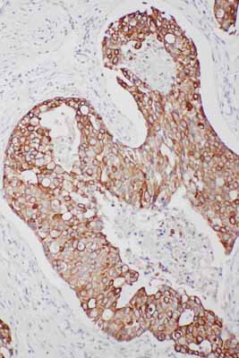 2 - Anti-TNFAIP8L3 Antibody ABO11567