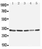 1 - Anti-TNFAIP8L3 Antibody ABO11567