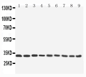 1 - Anti-APG5L/ATG5 Antibody ABO11570
