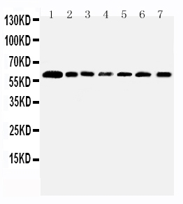1 - Anti-PRMT4 Antibody ABO11573