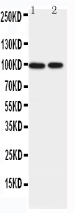 1 - Anti-EPB41L1 Antibody ABO11575
