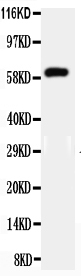 1 - Anti-HNF1 Beta Antibody ABO11576
