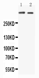 1 - Anti-Huntingtin Antibody ABO11577