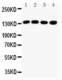 1 - Anti-IRS1 Antibody ABO11578