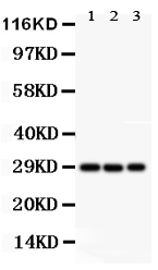 1 - Anti-CSEN Antibody ABO11581