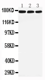 1 - Anti-LRP5 Antibody ABO11582