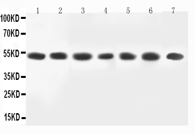 1 - Anti-MEK2 Antibody ABO11583