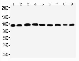 1 - Anti-Plakophilin 2 Antibody ABO11587