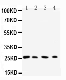 1 - Anti-Rab3C Antibody ABO11588