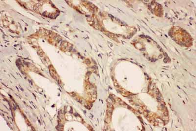 2 - Anti-RAB8A Antibody ABO11589