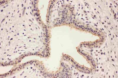 2 - Anti-RAB8A Antibody ABO11589