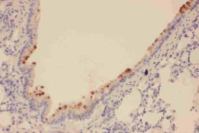 2 - Anti-SOX2 Antibody ABO11593