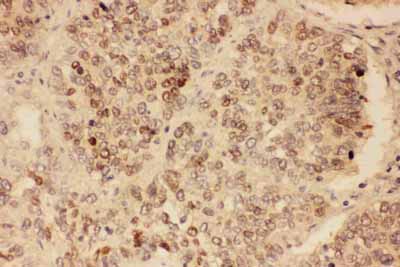 2 - Anti-SOX2 Antibody ABO11593