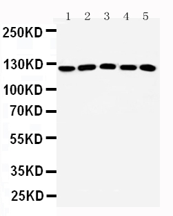 1 - Anti-ST5 Antibody ABO11596