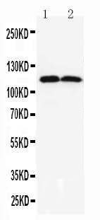 1 - Anti-TMEM16A Antibody ABO11599