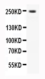 1 - Anti-CaV1.3 Antibody ABO11601