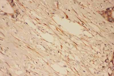 2 - Anti-PSD95 Antibody ABO11603