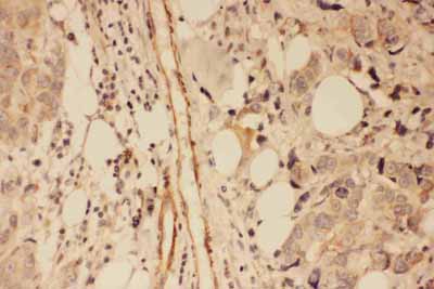 2 - Anti-PSD95 Antibody ABO11603